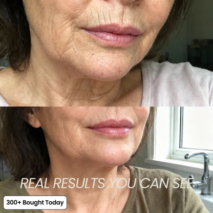 🔥LAST DAY 60% OFF Freshnixx Korean Pink Collagen Volume Multi Balm