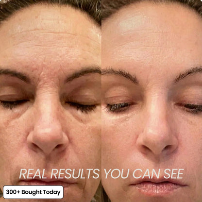 🔥LAST DAY 60% OFF Freshnixx Korean Pink Collagen Volume Multi Balm